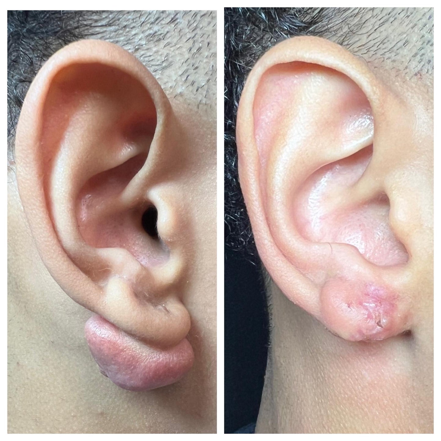 Body Mod