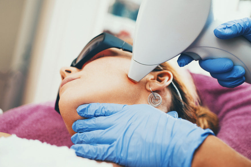 Depilación Láser Patillas