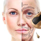 PROMO Fibroplasma - Rostro Completo